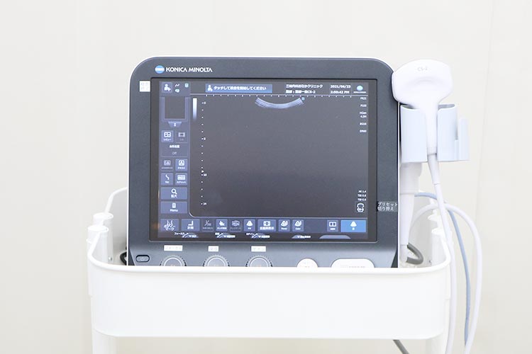 超音波診断装置