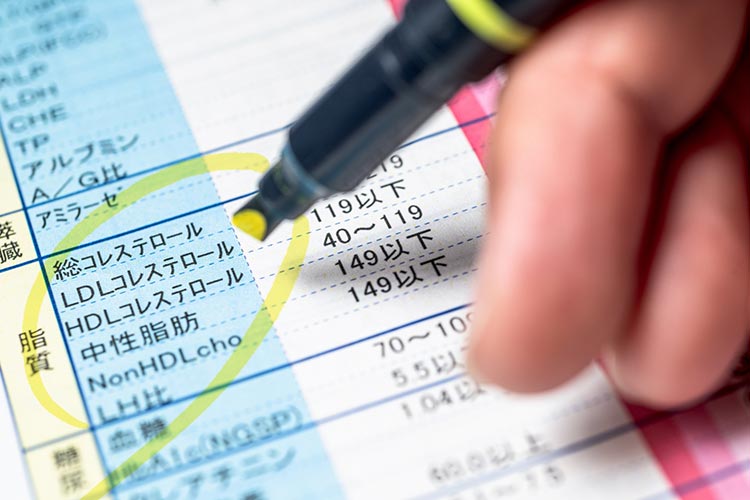 脂質異常症のイメージ写真